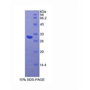 肌球蛋白ⅠA(MYO1A)重组蛋白