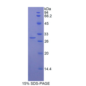 肌球蛋白ⅠG(MYO1G)重组蛋白,Recombinant Myosin IG (MYO1G)