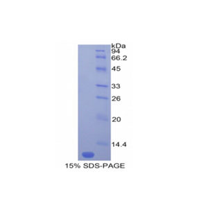 单核细胞趋化蛋白5(MCP5)重组蛋白,Recombinant Monocyte Chemotactic Protein 5 (MCP5)