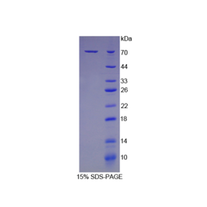 70kDa热休克蛋白1B(HSPA1B)重组蛋白