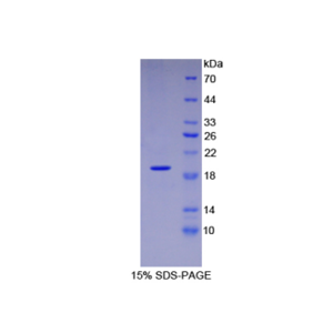 血小板反应蛋白解整合素金属肽酶12(ADAMTS12)重组蛋白