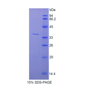 CutC铜转运蛋白(CUTC)重组蛋白,Recombinant CutC Copper Transporter (CUTC)