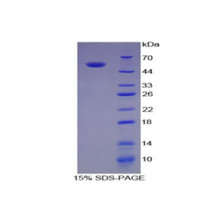 白介素35(IL35)重组蛋白