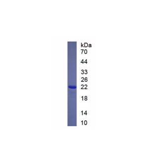 B-细胞淋巴瘤因子2样蛋白2(Bcl2L2)重组蛋白,Recombinant B-Cell CLL/Lymphoma 2 Like Protein 2 (Bcl2L2)