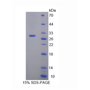 白介素17受體C(IL17RC)重組蛋白,Recombinant Interleukin 17 Receptor C (IL17RC)