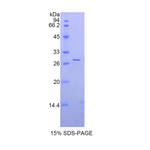 解整合素金属蛋白酶5(ADAM5)重组蛋白