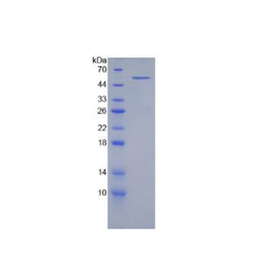 整合素β2(CD18)重组蛋白