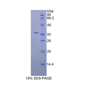 70kDaζ链关联蛋白激酶(zAP70)重组蛋白