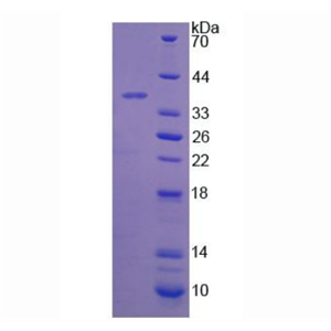 17-β-羟基类固醇脱氢酶12(HSD17b12)重组蛋白
