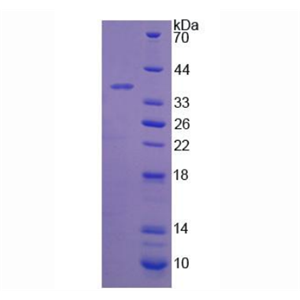 17-β-羟基类固醇脱氢酶12(HSD17b12)重组蛋白,Recombinant 17-Beta-Hydroxysteroid Dehydrogenase Type 12 (HSD17b12)