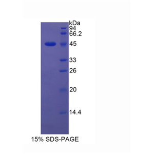 脂质运载蛋白5(LCN5)重组蛋白,Recombinant Lipocalin 5 (LCN5)