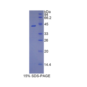 脂质运载蛋白9(LCN9)重组蛋白,Recombinant Lipocalin 9 (LCN9)