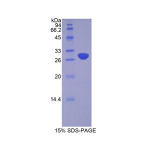 解整合素金屬蛋白酶20(ADAM20)重組蛋白,Recombinant A Disintegrin And Metalloprotease 20 (ADAM20)