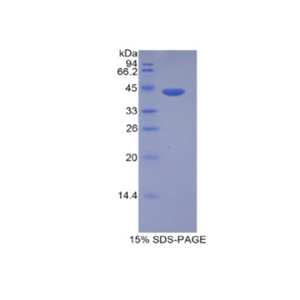 組蛋白1簇H2ad(HIST1H2AD)重組蛋白,Recombinant Histone Cluster 1, H2ad (HIST1H2AD)