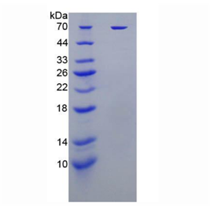 杀伤细胞免疫球蛋白样受体2DL1(KIR2DL1)重组蛋白,Recombinant Killer Cell Immunoglobulin Like Receptor 2DL1 (KIR2DL1)