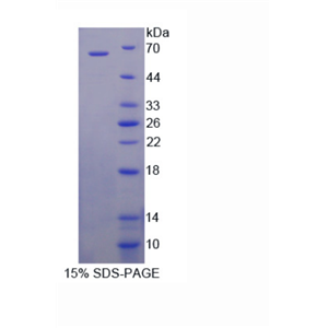 杀伤细胞免疫球蛋白样受体3DL2(KIR3DL2)重组蛋白