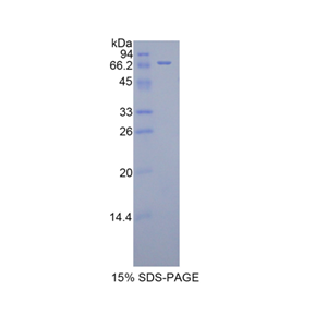 杀伤细胞免疫球蛋白样受体3DL3(KIR3DL3)重组蛋白