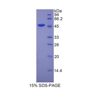脂质运载蛋白4(LCN4)重组蛋白