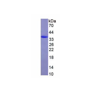 CD163分子(CD163)重組蛋白,Recombinant Cluster Of Differentiation (CD163)