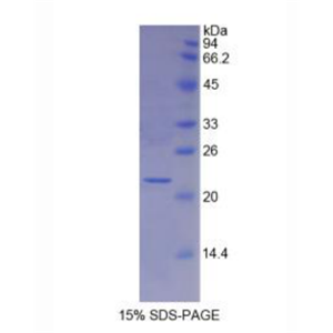 肌球蛋白轻链4(MYL4)重组蛋白,Recombinant Myosin Light Chain 4, Alkali, Atrial, Embryonic (MYL4)