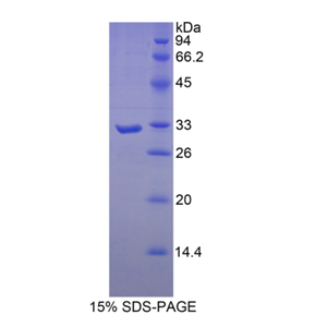肌球蛋白重链16(MYH16)重组蛋白