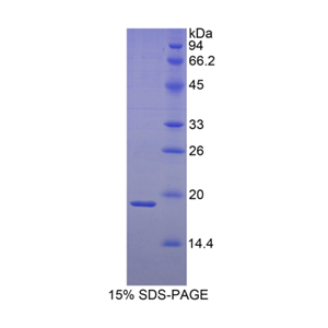热休克蛋白β3(HSPb3)重组蛋白