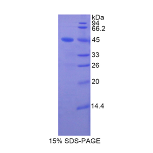 脂质运载蛋白8(LCN8)重组蛋白,Recombinant Lipocalin 8 (LCN8)