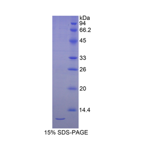 硒蛋白W1(SEPW1)重组蛋白,Recombinant Selenoprotein W1 (SEPW1)