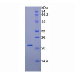 CD8b分子(CD8b)重组蛋白