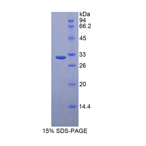低密度脂蛋白受体相关蛋白5样蛋白(LRP5L)重组蛋白