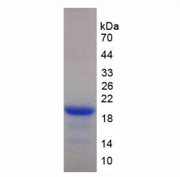 杀伤细胞凝集素样受体亚家族D成员1(KLRD1)重组蛋白,Recombinant Killer Cell Lectin Like Receptor Subfamily D, Member 1 (KLRD1)