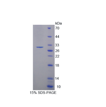 肌球蛋白轻链激酶3(MYLK3)重组蛋白,Recombinant Myosin Light Chain Kinase 3 (MYLK3)