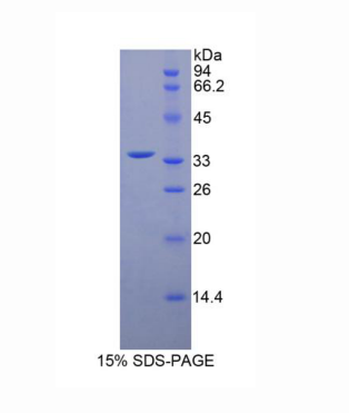 肌球蛋白轻链激酶4(MYLK4)重组蛋白,Recombinant Myosin Light Chain Kinase 4 (MYLK4)