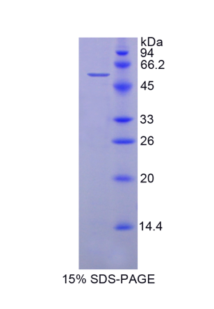 70kDa热休克蛋白14(HSPA14)重组蛋白,Recombinant Heat Shock 70kDa Protein 14 (HSPA14)