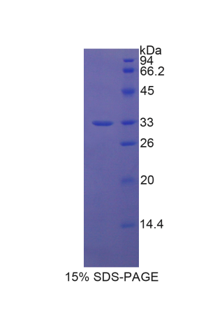 阴离子/糖转运蛋白(AST)重组蛋白,Recombinant Anion/Sugar Transporter (AST)