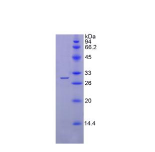 鞘氨醇1磷酸酯裂解酶1(SGPL1)重組蛋白,Recombinant Sphingosine 1 Phosphate Lyase 1 (SGPL1)