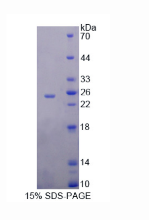 泛连接蛋白1(PANX1)重组蛋白,Recombinant Pannexin 1 (PANX1)