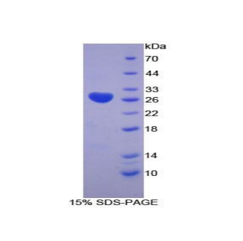 赖氨酰氧化酶样蛋白3(LOXL3)重组蛋白,Recombinant Lysyl Oxidase Like Protein 3 (LOXL3)