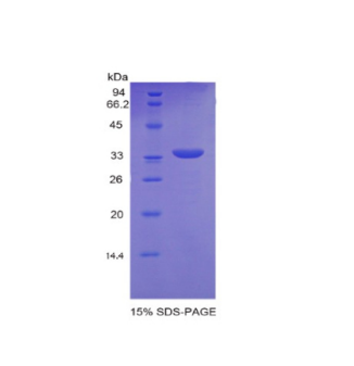 副腫瘤抗原MA2(PNMA2)重組蛋白,Recombinant Paraneoplastic Antigen MA2 (PNMA2)