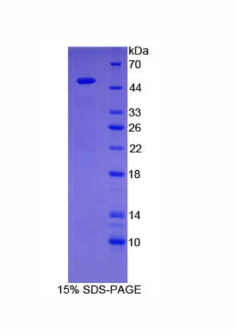 半乳糖-3-O-磺基轉(zhuǎn)移酶1(GAL3ST1)重組蛋白,Recombinant Galactose-3-O-Sulfotransferase 1 (GAL3ST1)