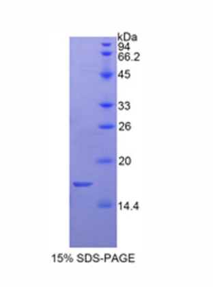 血小板膜糖蛋白Ⅰbβ多肽(GP1BB)重组蛋白,Recombinant Platelet Glycoprotein Ib Beta Chain (GP1BB)