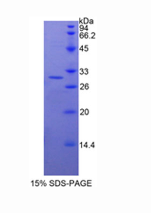 血小板膜糖蛋白Ⅰbβ多肽,Recombinant Toll Interacting Protein (TOLLIP)