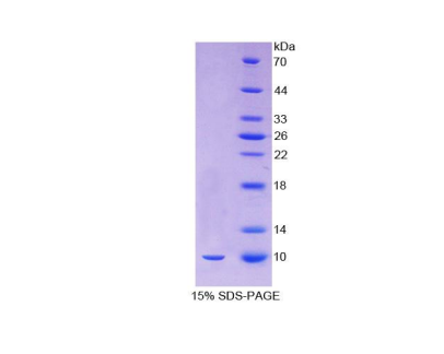 癌調(diào)蛋白(OCM)重組蛋白,Recombinant Oncomodulin (OCM)