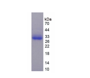 TNFRSF1A關(guān)聯(lián)Via死亡域蛋白(TRADD)重組蛋白,Recombinant TNFRSF1A Associated Via Death Domain Protein (TRADD)