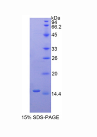 Ly1抗体反应同源物(LYAR)重组蛋白,Recombinant Ly1 Antibody Reactive Homolog (LYAR)