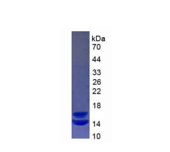 钙卫蛋白(CALPRO)重组蛋白,Recombinant Calprotectin (CALPRO)