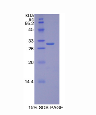 耐扭蛋白1B(TOR1B)重组蛋白,Recombinant Torsin 1B (TOR1B)