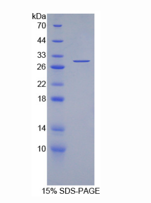 耐扭蛋白3A(TOR3A)重组蛋白,Recombinant Torsin 3A (TOR3A)