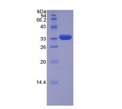 TNF受体关联因子5(TRAF5)重组蛋白,Recombinant TNF Receptor Associated Factor 5 (TRAF5)