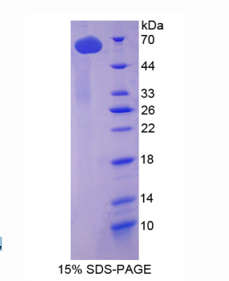 微管蛋白δ(TUBd)重組蛋白,Recombinant Tubulin Delta (TUBd)